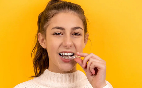 Aligneurs transparents blog 01