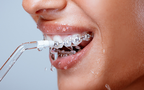 Hygiene buccodentaire blog1