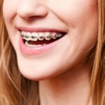 Orthodontie multi‑attaches Cover