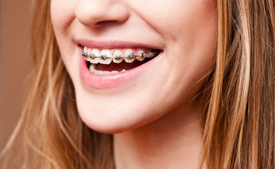 Orthodontie multi‑attaches Cover